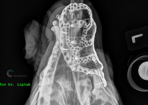 Top down x-ray image with implant in place