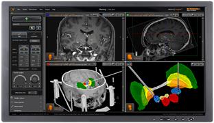 neuroinspire™ surgical planning software